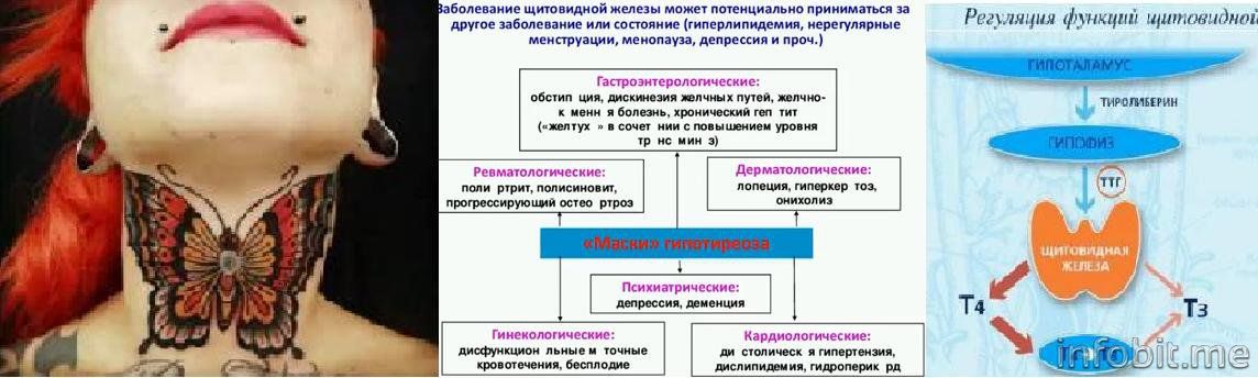 Реклама Щитовидки- Вебинар Дмитриевой.JPG