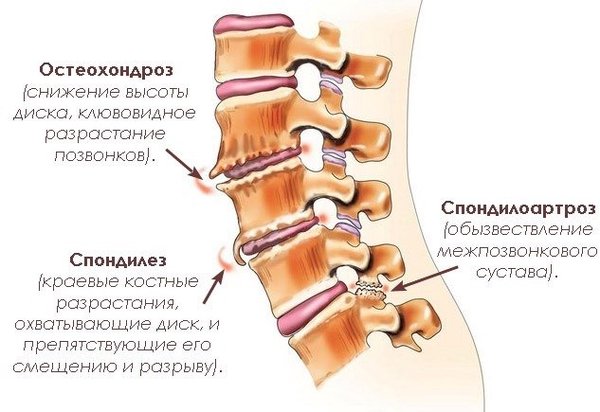 i12.pixs.ru_storage_6_9_8_1jpg_6020001_23690698.jpg