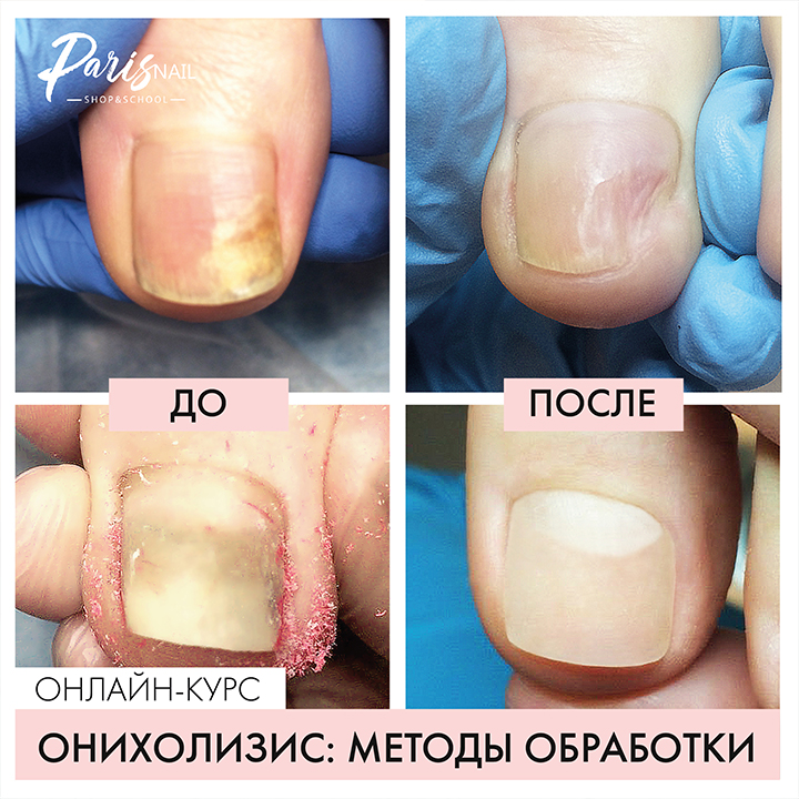 parisnail.ru_upload_iblock_786_1_01.jpg